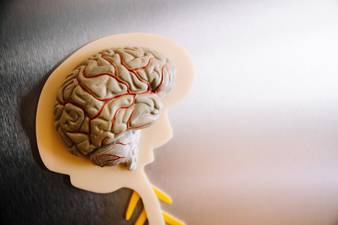 Nõdravõitu intellekt pälvib tehisaruajastul teenimatut tunnustust | R2 Portaal