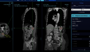 Tehisaru aitab neeruvähki kiiremini avastada | Tervis