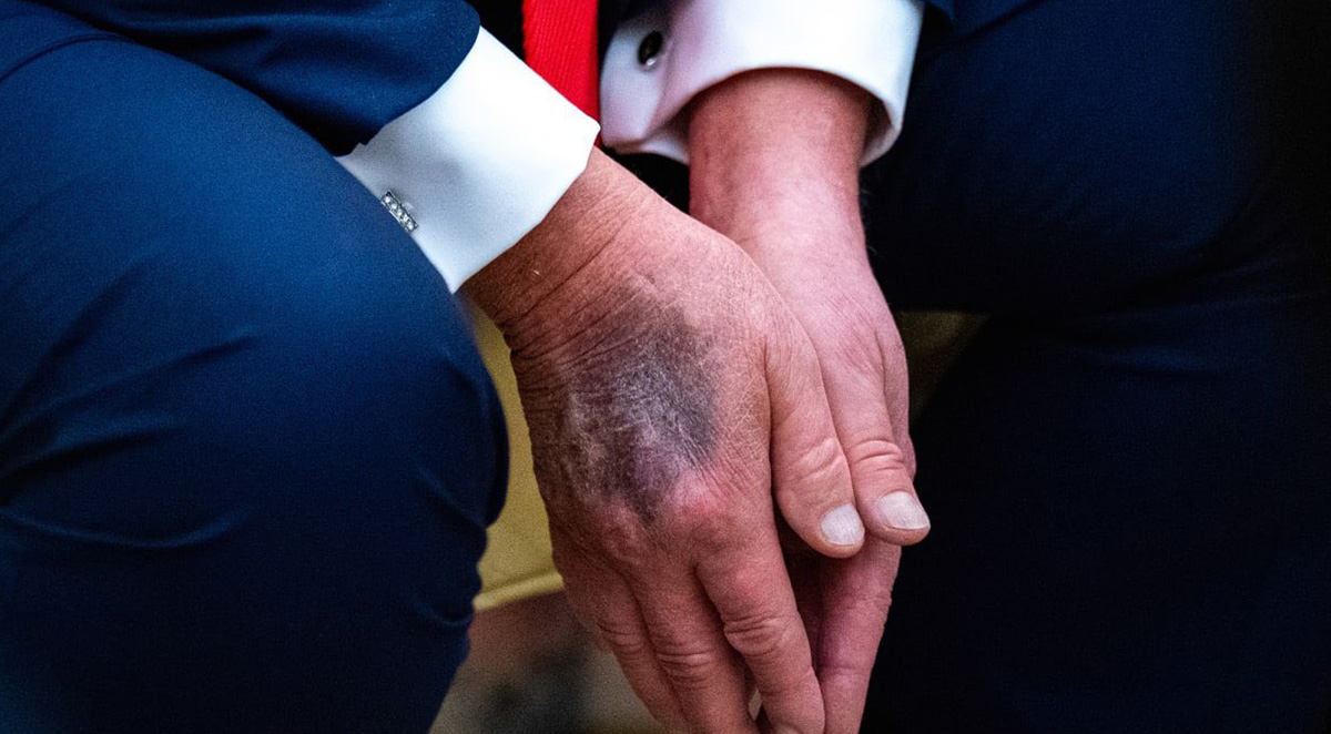 Trump edastas kurjakuulutava sõnumi oma tervise kohta