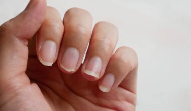 Kas su küüned murduvad ja kihistuvad? Väldi neid vigu