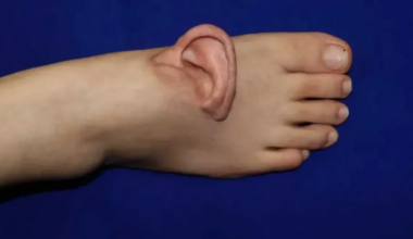 Sellele hiina naisele õmmeldi kõrv jala külge – miks küll?