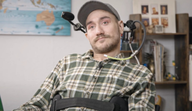 Primeros errores en el hombre que tiene un chip en el cerebro implantado por Neuralink de Elon Musk