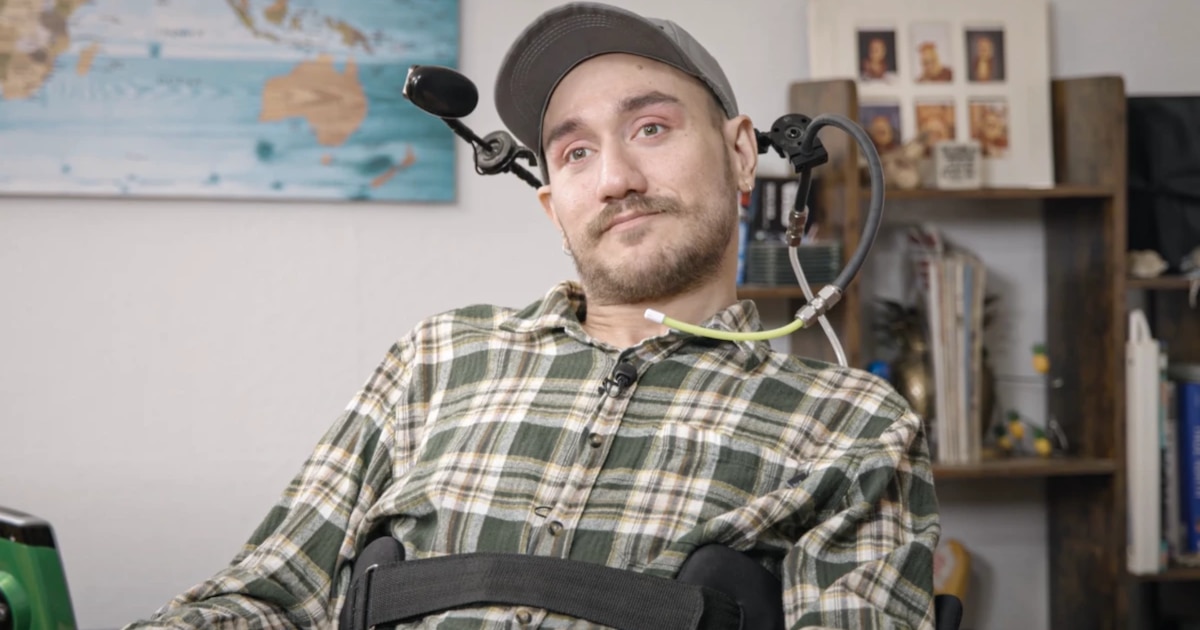 Primeros errores en el hombre que tiene un chip en el cerebro implantado por Neuralink de Elon Musk