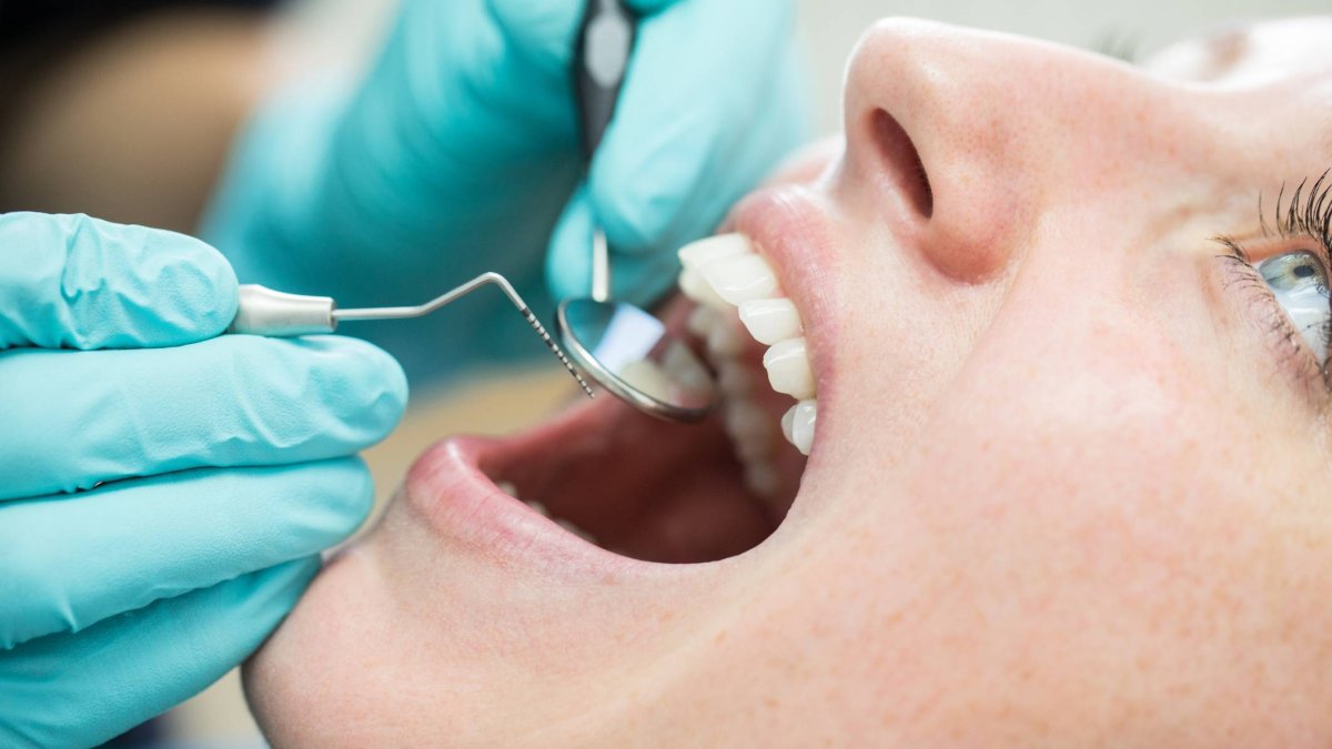 el aviso de una dentista sobre el lado desconocido de tu sonrisa