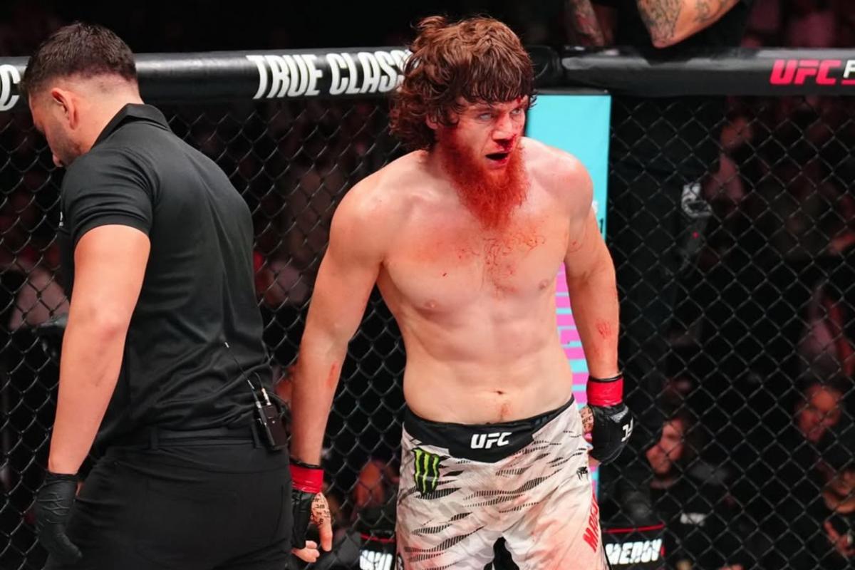 Shara Magomedov, operado con éxito de la nariz tras el UFC Abu Dhabi