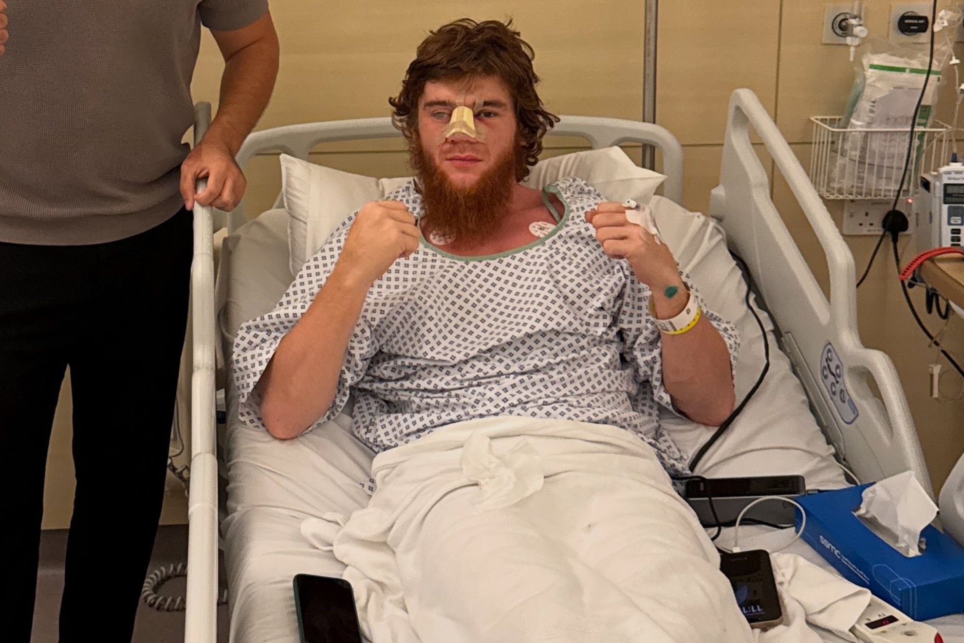 Shara Magomedov, tras ser operado de la nariz.