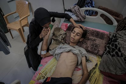 Atif Aid Abu Khater, un adolescente palestino de 17 años que pesa solo 25 kilos debido a la desnutrición, recibe tratamiento en condiciones limitadas en el hospital Al Shifa de la ciudad de Gaza, el 25 de julio de 2025. 