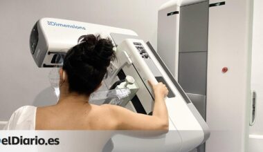 Virus respiratorios como la gripe 'despiertan' células metastásicas de cáncer de mama en los pulmones