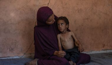 El hambre en Gaza se ensaña con decenas de miles de niños: la malnutrición se triplica en menores de 5 años | Internacional