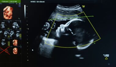 Los 'químicos eternos' afectan el sistema inmune de mujeres embarazadas y sus fetos