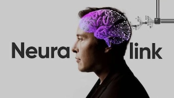 Neuralink falla en su primer