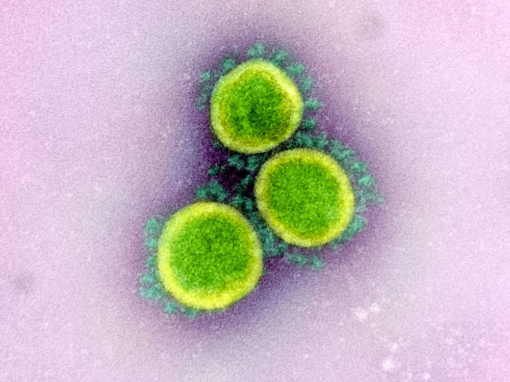 sars-cov-2