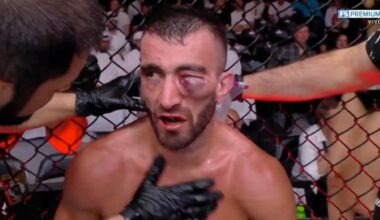 Mohammad Yahya recibe BRUTAL castigo en ojo tras pelea con Steven Nguyen; imágenes sensibles – Fox Sports