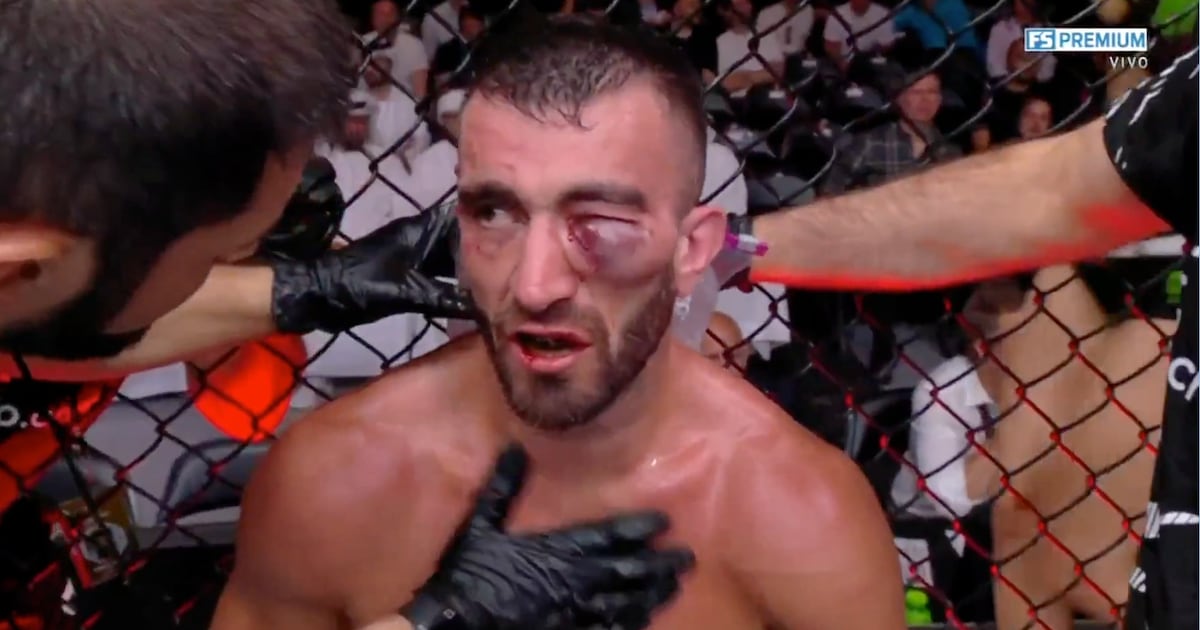Mohammad Yahya recibe BRUTAL castigo en ojo tras pelea con Steven Nguyen; imágenes sensibles – Fox Sports