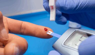 Detectan subtipos de células desconocidos y vinculados a un mayor riesgo de diabetes