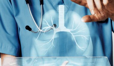Nuevos pasos hacia una mayor precisión en el diagnóstico del cáncer de pulmón