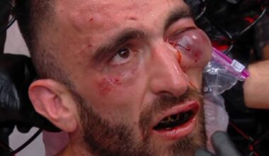 Mohammad Yahya quedó con un ojo a punto de explotar y pararon su pelea con Steven Nguyen