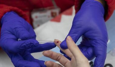 La Comisión Europea autoriza la primera terapia inyectable semestral para prevenir el VIH