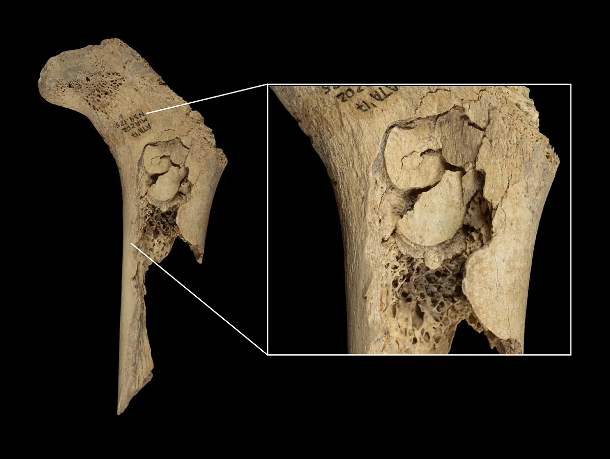 Nuevo caso de canibalismo humano en Atapuerca: 11 personas fueron descuartizadas, cocinadas y devoradas hace 5.700 años - El Mundo