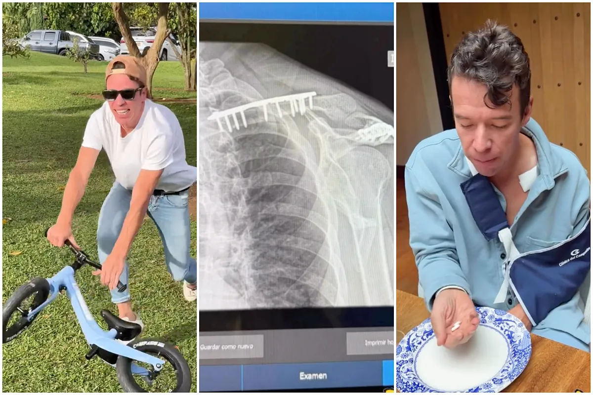 Increíble accidente de Rigoberto Urán en bicicleta de su hija: Lo operaron por fractura de clavícula - MARCA