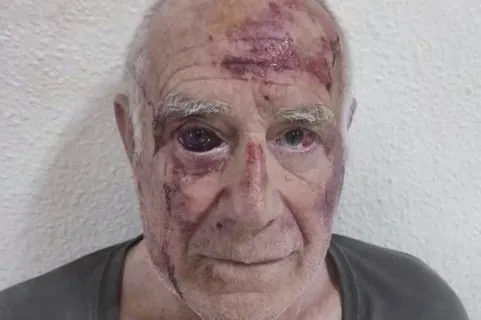 Detienen en Francia a uno de los implicados en la agresión de Torre Pacheco (Murcia) - El Mundo