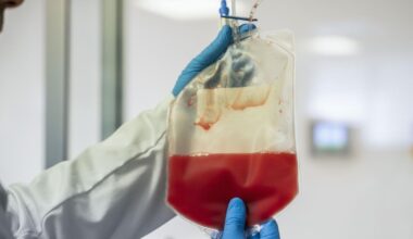 El riesgo de cáncer secundario por recibir terapias CAR-T es bajo, según un amplio estudio