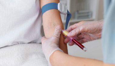Un análisis de sangre puede predecir si un tratamiento funcionará, avance del CNIO con un 87% de acierto