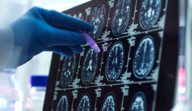 Investigadores del CSIC desarrollan una escala genética más precisa para mejorar la detección precoz del alzhéimer