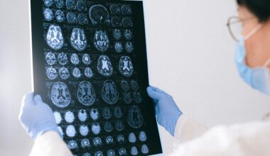Un estudio de la Universidad de Harvard demuestra la eficacia del litio contra el alzhéimer