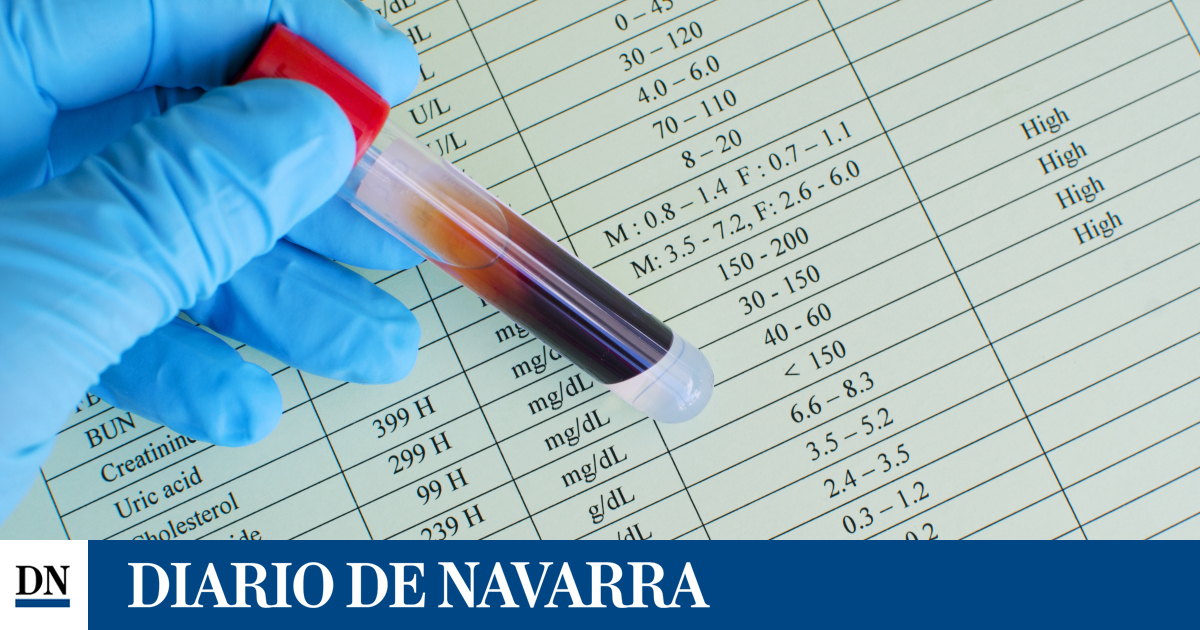 Los niveles altos de triglicéridos causan aneurismas aórticos abdominales, según un estudio
