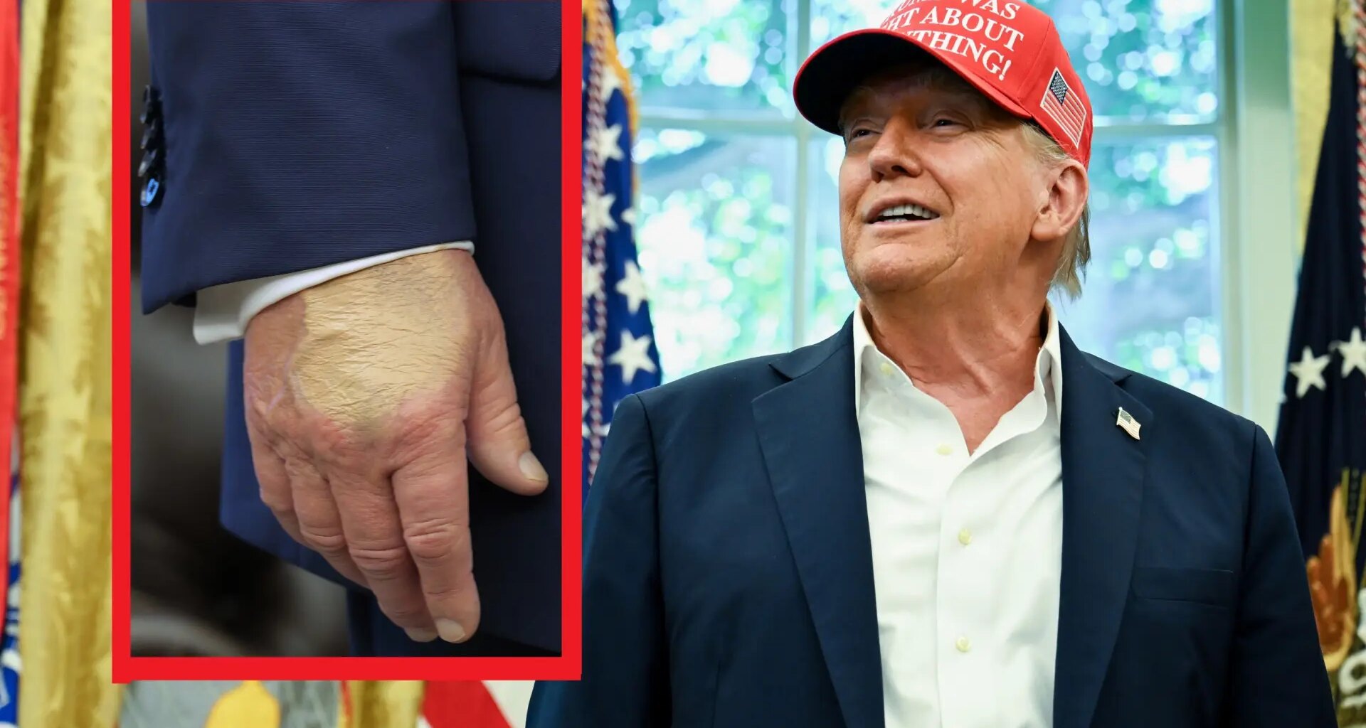 Una capa de maquillaje en una mano de Donald Trump dispara de nuevo los rumores sobre su salud