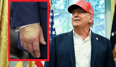 Una capa de maquillaje en una mano de Donald Trump dispara de nuevo los rumores sobre su salud