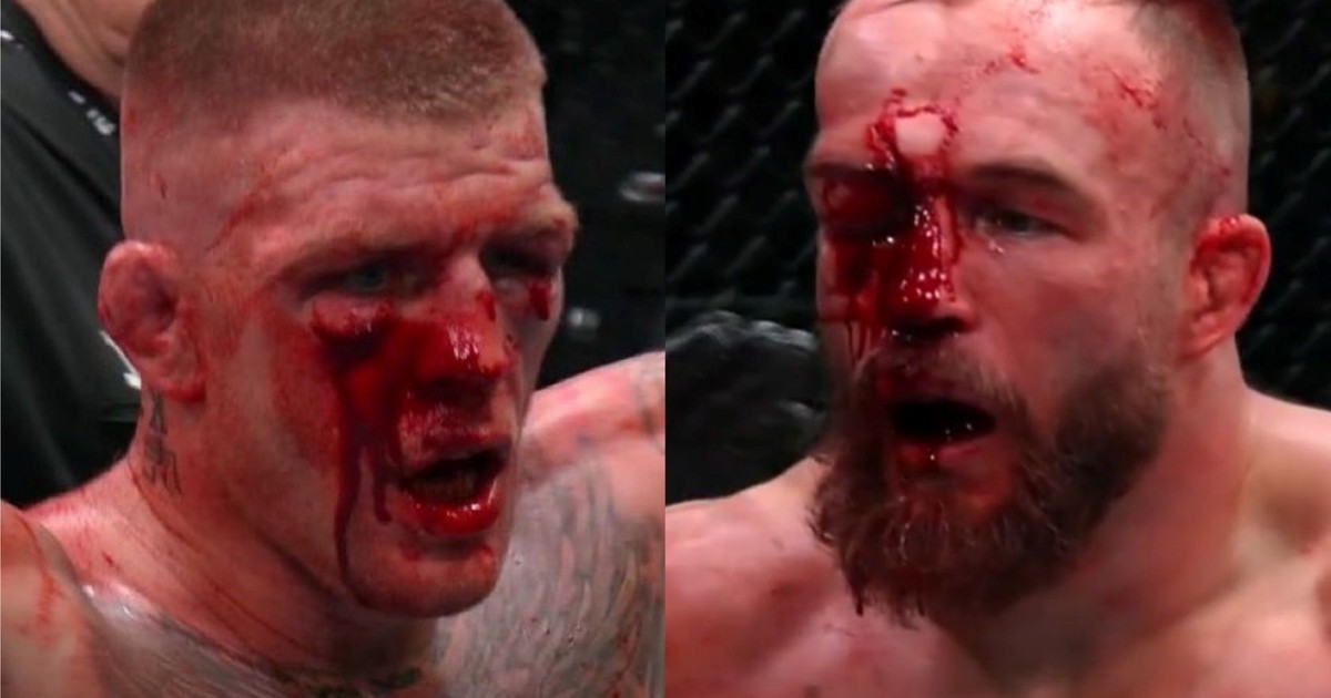¡Una batalla sangrienta! Así quedaron los rostros de Chris Duncan y Mateusz Rebecki tras un épico combate en el UFC Fight Night :: Olé USA