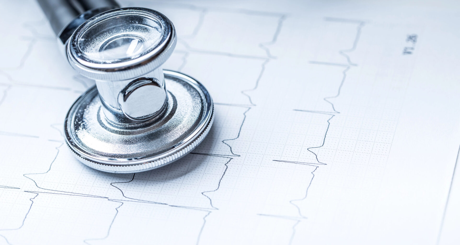 betabloqueantes sin beneficio tras infarto