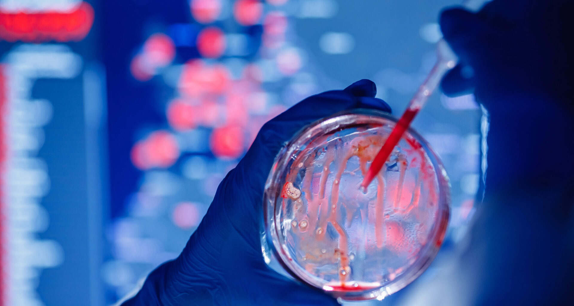 La sepsis aumenta la mortalidad en pacientes sanos si no se detecta a tiempo