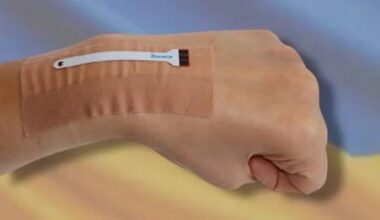 Piel electrónica que se cura y adapta como tejido humano