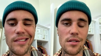 Justin Bieber, durante el peor