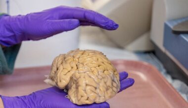 cerebros jóvenes, neuronas únicas y una vida social activa