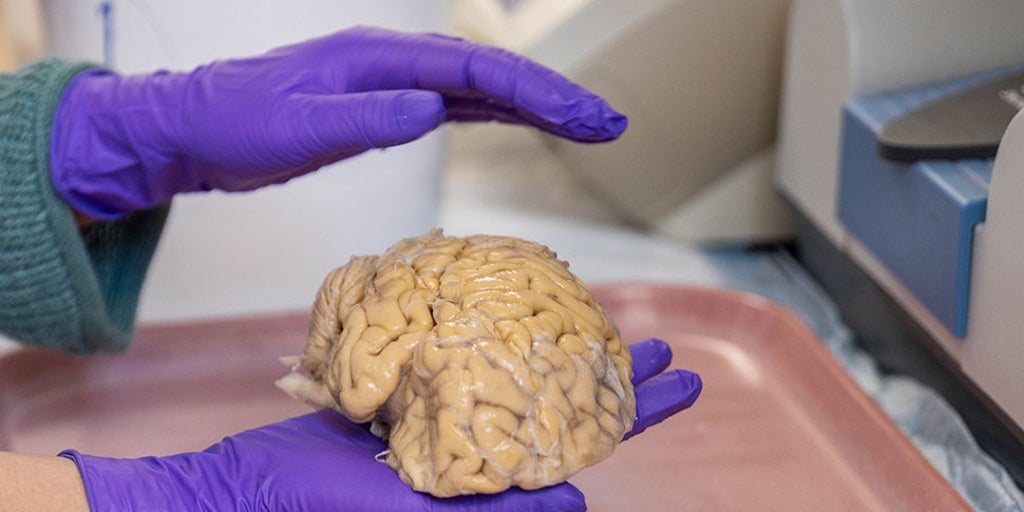 cerebros jóvenes, neuronas únicas y una vida social activa