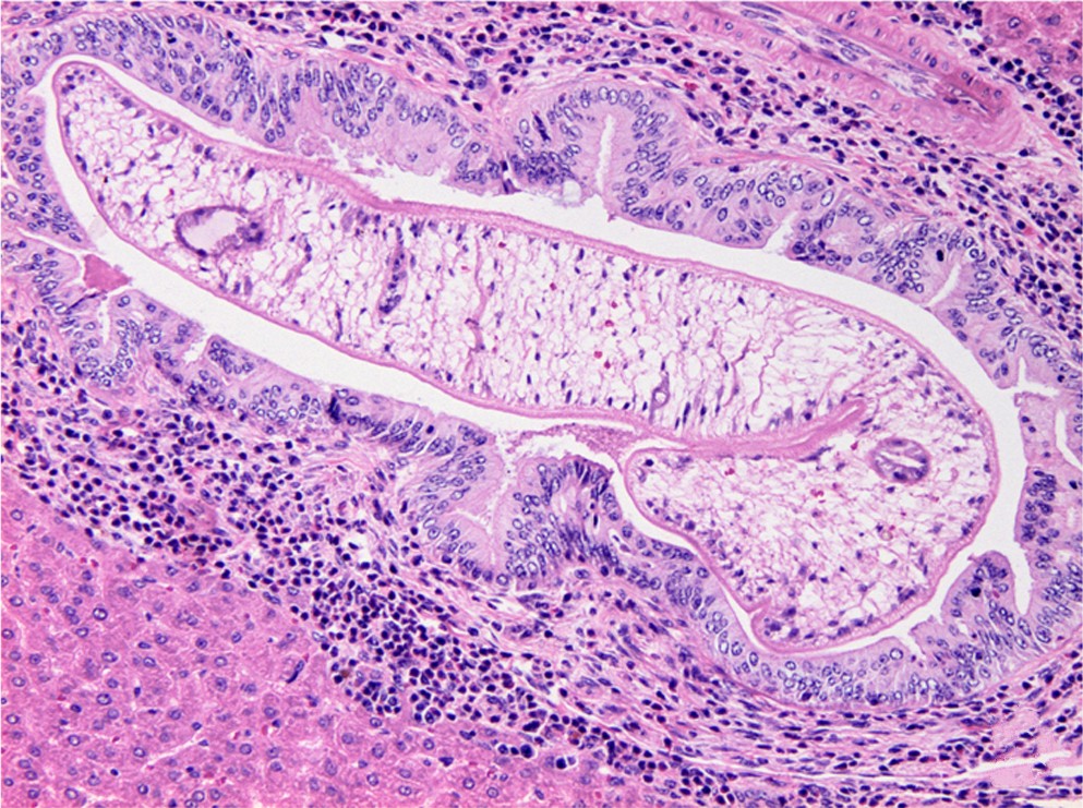 Dos biomarcadores mejoran el diagnóstico de la opistorquiasis y cáncer biliar