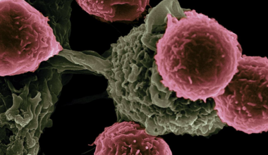 Una nueva vacuna muestra potencial para prolongar la supervivencia en cáncer de páncreas y colon