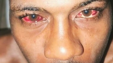 Derrames y una boca aplastada: los estragos de Khamzat Chimaev, la mayor bestia de la UFC