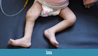 Dos bebés de tres y cinco meses mueren en Gaza por desnutrición
