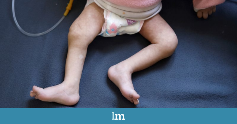 Dos bebés de tres y cinco meses mueren en Gaza por desnutrición