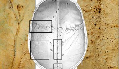 Describen una red de microcanales en el cráneo que podría ser clave en las enfermedades neurológicas