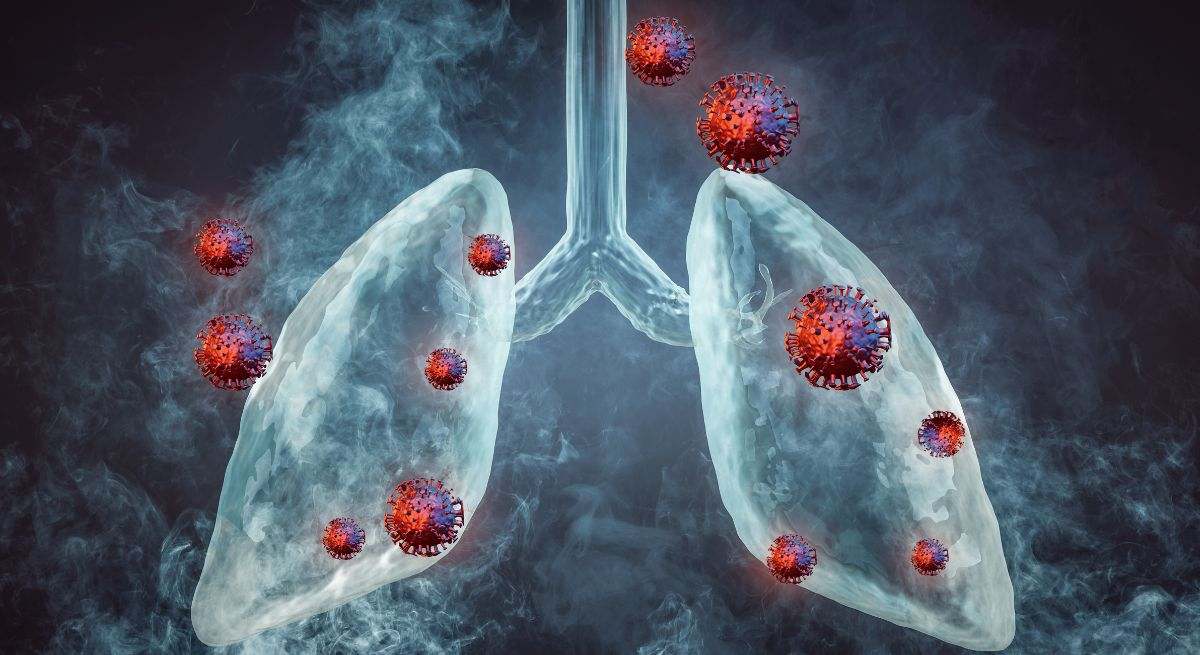 Investigadores detectan el arma secreta contra el cáncer de pulmón más agresivo del mundo: mejora el diagnóstico