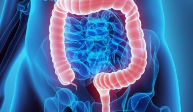 El envío postal de una prueba inmunoquímica fecal mejora la detección de cáncer colorrectal en adultos jóvenes