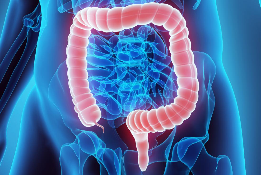 El envío postal de una prueba inmunoquímica fecal mejora la detección de cáncer colorrectal en adultos jóvenes