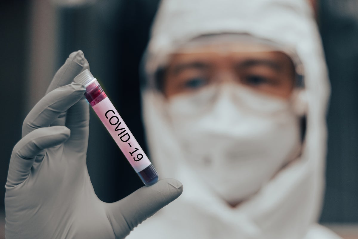 Covid-19: nuevo estudio revela el preocupante impacto que puede tener la infección en los vasos sanguíneos