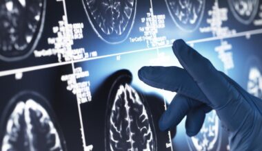 Los investigadores allanan el camino hacia frenar el envejecimiento cerebral al dar con una proteína clave